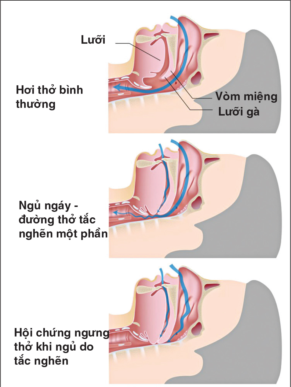 Cách chẩn đoán về bệnh